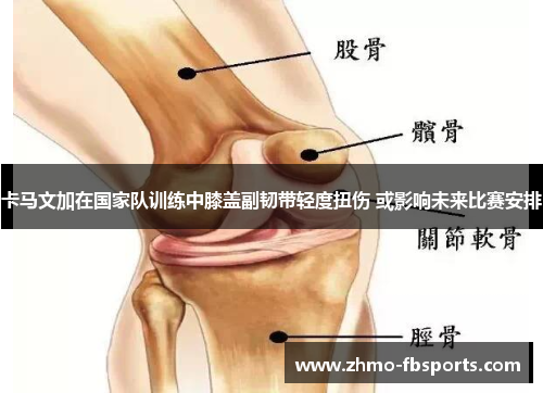 卡马文加在国家队训练中膝盖副韧带轻度扭伤 或影响未来比赛安排 卡马文加在国家队训练中膝盖副韧带轻度扭伤 或影响未来比赛安排